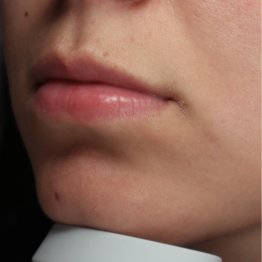 Lippen zijkant VOOR